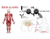 Những người tiêu thụ đường trong thời gian dài tăng nguy cơ mắc bệnh tự miễn dịch